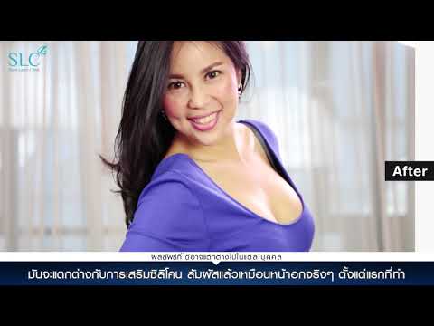 ชุดของสาวที่มีหน้าอกเล็ก ขนาดเทียม 350 เต้านม