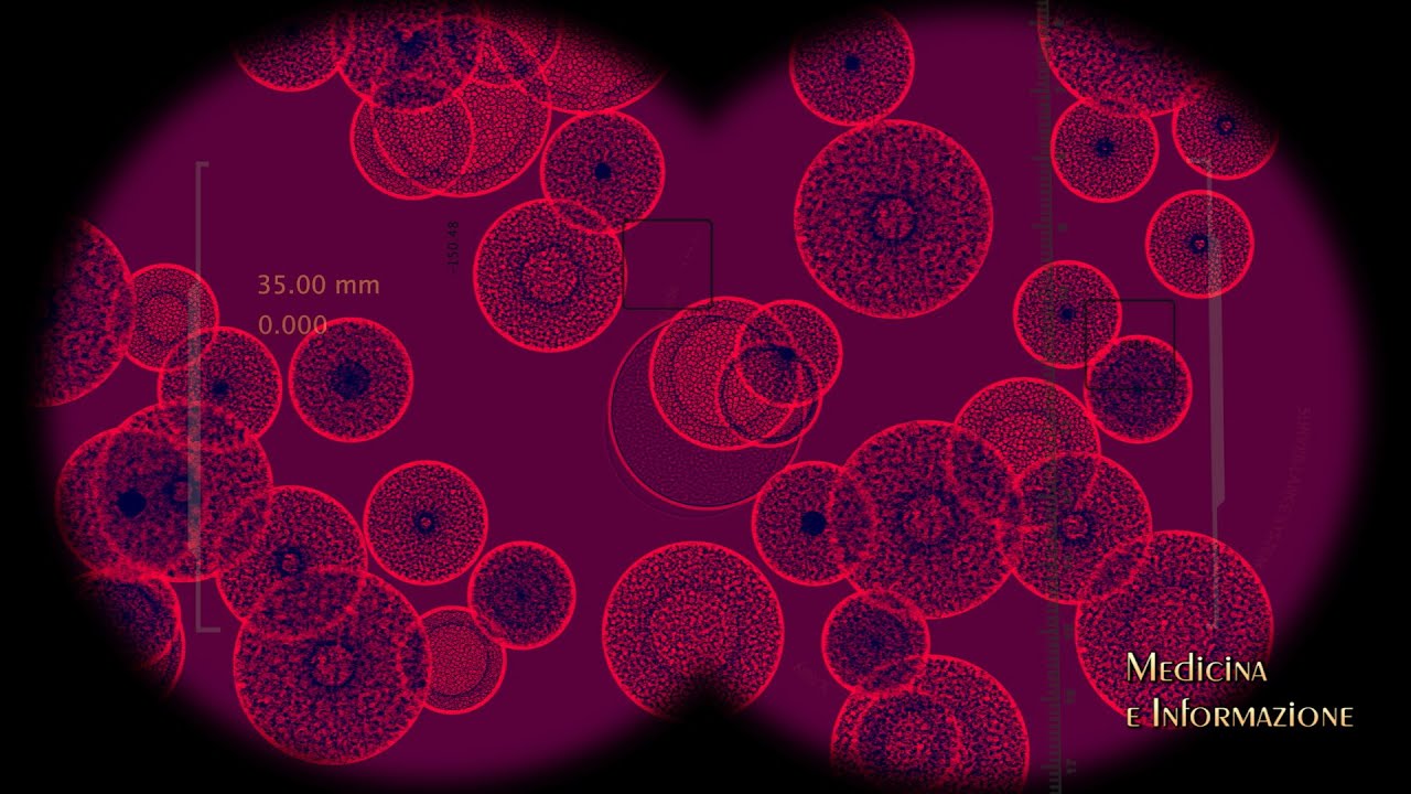 Infezioni Ospedaliere e Antibiotico Resistenza: le strategie per prevenirle e combatterle