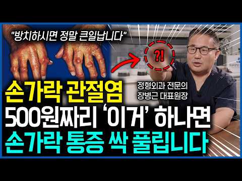 &#034;방치하시면 정말 큰일납니다&#034; 손가락 관절염 500원짜리 '이거' 하나면 손가락 통증 싹 풀립니다ㅣ당신의통닥…