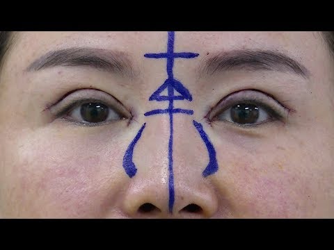 Arab Today- Plastic surgery has become a big business in China