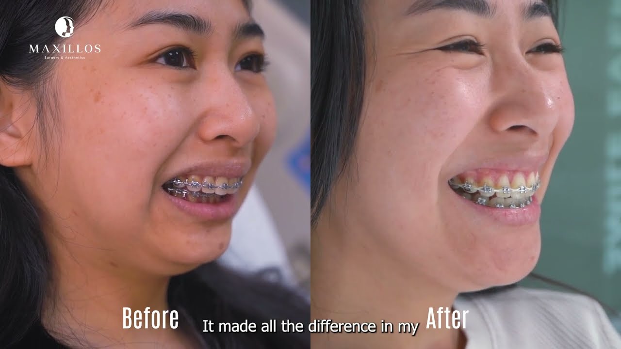 Rubén Ascencio Padilla-13