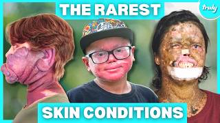 Download lagu The World's Rarest Skin Conditions | BORN DIFFERENT mp3