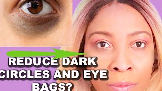 How to get rid of dark circles, eye bags and puffy under eyes + under eyes wrinkles and crows feet