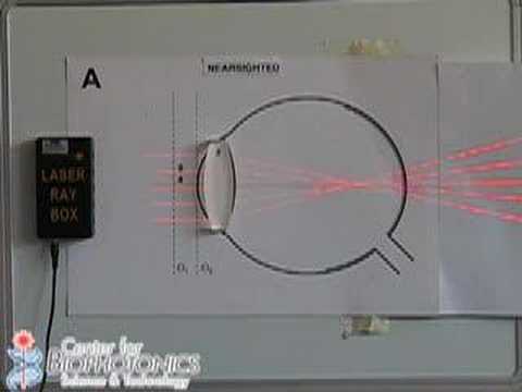 Biophotonics and Vision Correction