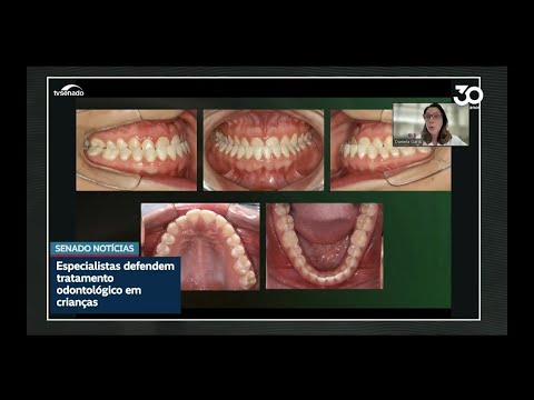 Dentistas defendem tratamento de problemas ortodônticos na infância