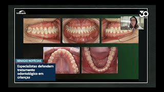 Dentistas defendem tratamento de problemas ortodônticos na infância