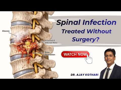 Can Spinal Infection Be Treated Without Surgery? | Dr. Ajay Kothari