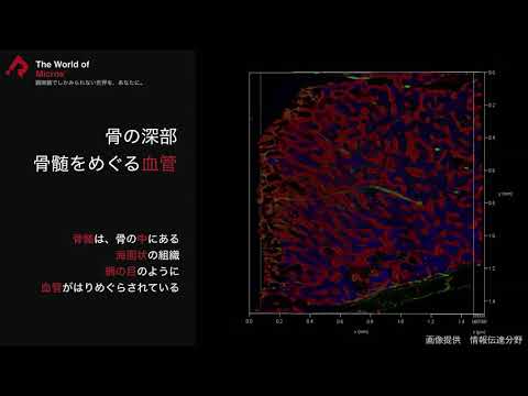 The World of Micros’ -骨と血管編-