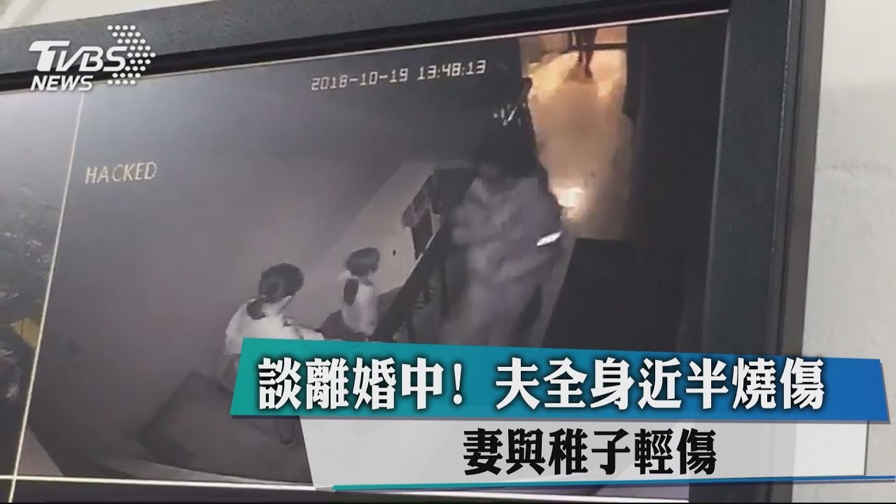 談離婚中!夫全身近半燒傷 妻與稚子輕傷