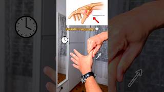 Cuando decides eliminar el dolor de pulgar 👍