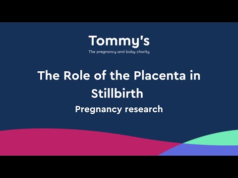 The Role of the Placenta in Stillbirth - Pregnancy Research | Tommy's