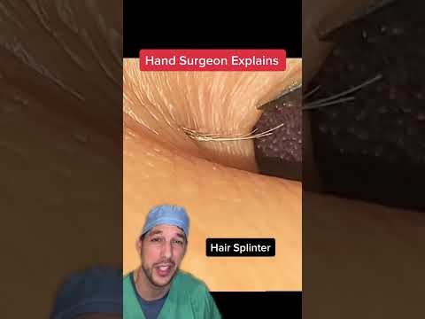 Hair splinters hurt! #Hair #Splinter #HairSplinter #Barber #Groomer #Dog #DogGroomer#Educational