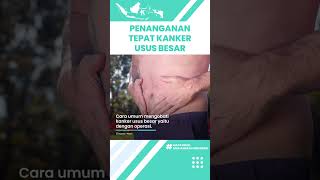 Penanganan Tepat Kanker Usus Besar yang Harus Diketahui, Mulai Kemoterapi hingga Terapi Radiasi