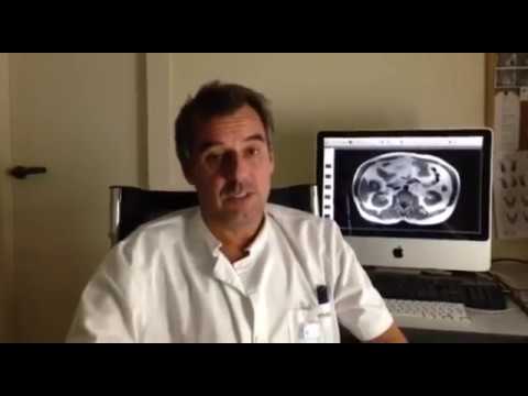 Inflamación de un nervio en la región torácica Inyecciones en la articulación de la rodilla
