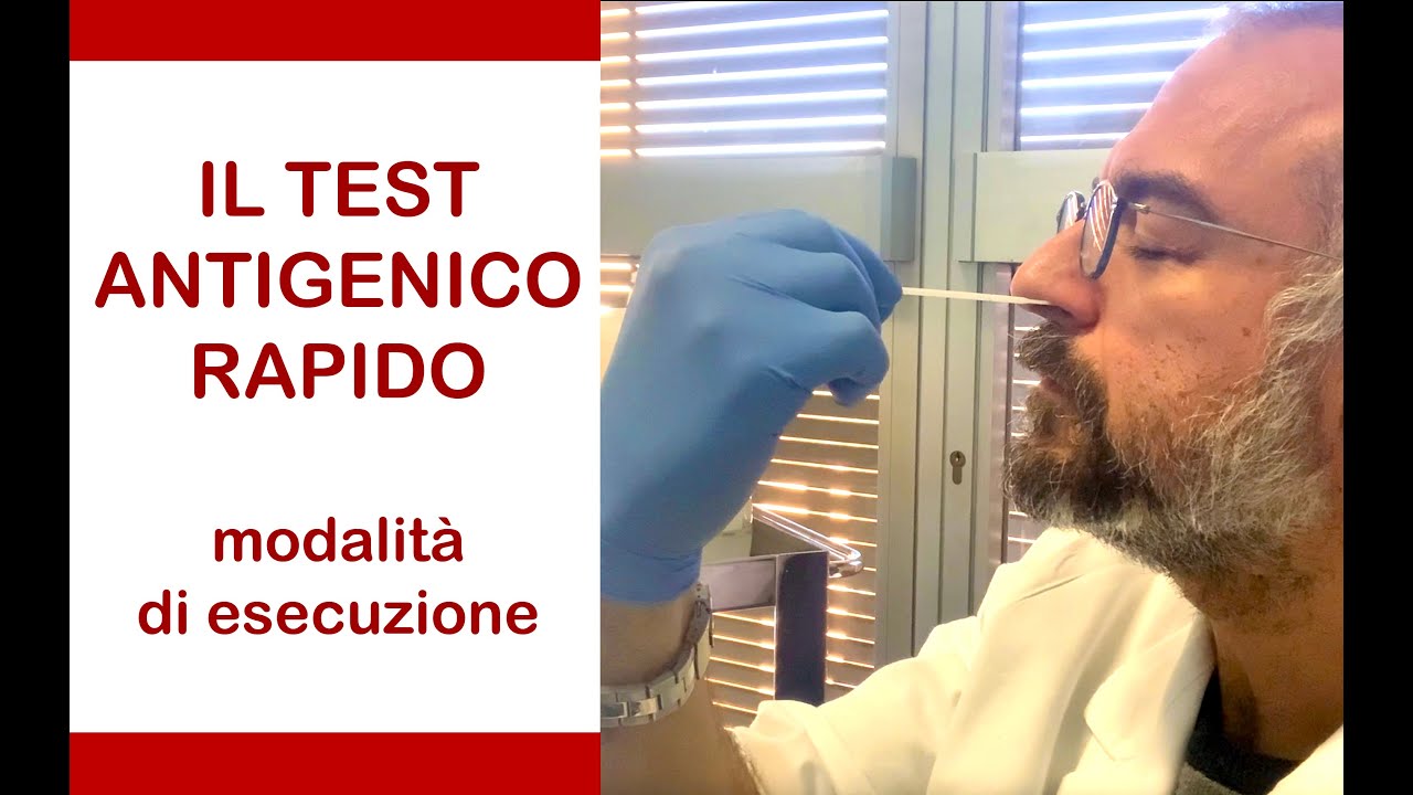 Watch Now Il #Test #Antigenico Rapido. Modalità di esecuzione passo dopo passo. Il #Test #Antigenico Rapido. Modalità di esecuzione passo dopo passo.