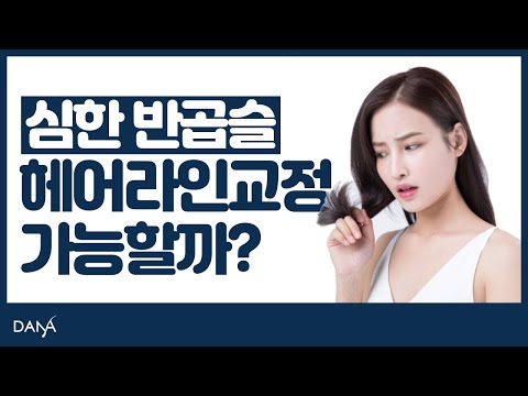 의느님답변????ㅣ심한 반곱슬시 헤어라인 교정 가능한가요? [의느님답변 97회]