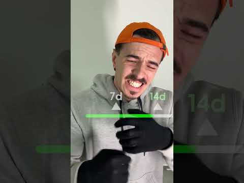 e se você usasse luvas por 1 mês?