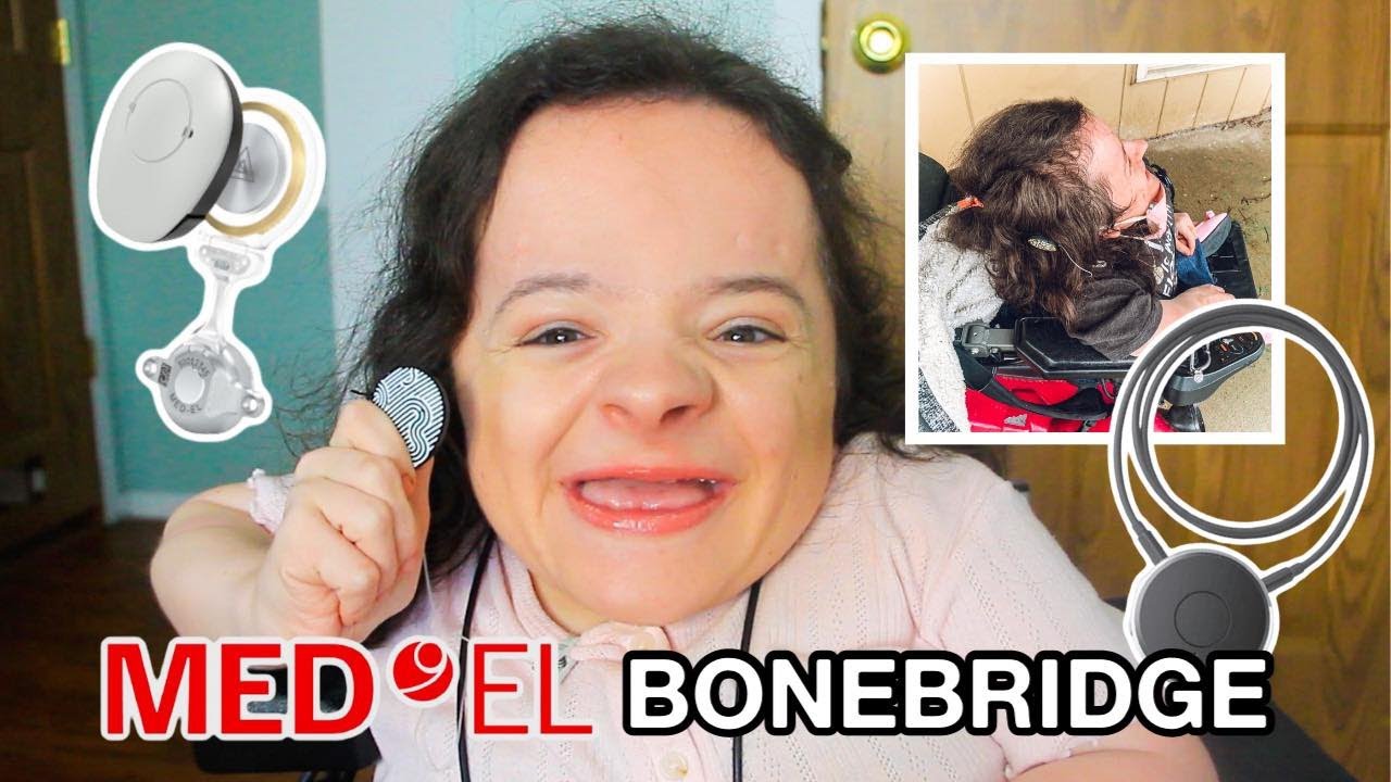 INTRODUCING MY BONE-ANCHORED HEARING AID! (MED-EL BONEBRIDGE) | FUNSIZEDSTYLE
