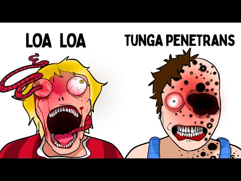 The Most Painful Parasites To Die From