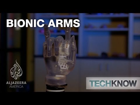 Bionic Arms - TechKnow