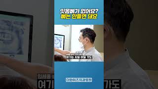 임플란트 과정, 임플란트수술 한국인이 좋아하는 속도로 (Implant procedure, Implant surgery, 임플란트 식립, 임플란트 전 과정 종류와 기구까지)