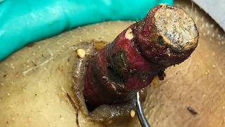 Download lagu 𝑺𝒐𝒐𝒕𝒉𝒊𝒏𝒈 𝑭𝒂𝒄𝒊𝒂𝒍 𝑻𝒓𝒆𝒂𝒕𝒎𝒆𝒏𝒕 𝒇𝒐𝒓 𝑺𝒕𝒓𝒆𝒔𝒔 𝑹𝒆𝒍𝒊𝒆𝒇 | 𝑫𝒆𝒆𝒑 𝑪𝒍𝒆𝒂𝒏𝒊𝒏𝒈 & 𝑪𝒂𝒍𝒎𝒊𝒏𝒈 𝑴𝒂𝒔𝒔𝒂𝒈𝒆 4203 mp3