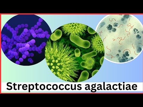 Streptococcus microbiology , Streptococcus agalactiae