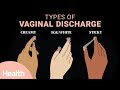 What Vaginal Discharge Says About Your Health Deep Dives Health