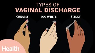 What Vaginal Discharge Says About Your Health | Deep Dives | Health