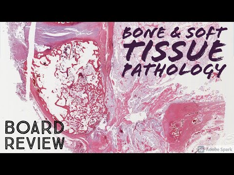 Bone & Soft Tissue Pathology Board Review: 20 Classic Cases (McGill pathology residents)