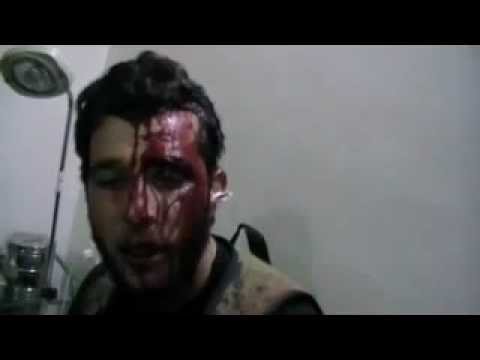 الملازم أول مرشد الخالد يتوعد قوات النظام بالعودة بعد إصابته في معركة السيطرة على بلدة الأتارب