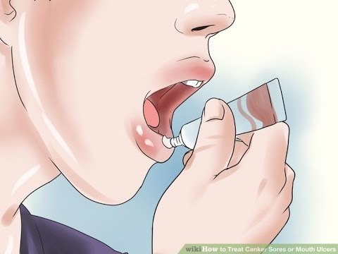 Medicine bilang upang mapupuksa ang kuko halamang-singaw Halamang-singaw lunas mahahalagang langis