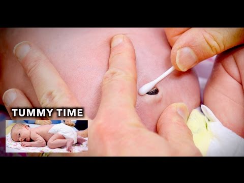 UMBILICAL CORD CLEANING & Infant Tummy Time | Dr. Paul