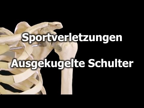 Arthrose des Sprunggelenks Behandlungsprodukte Tendinitis Schultergelenk