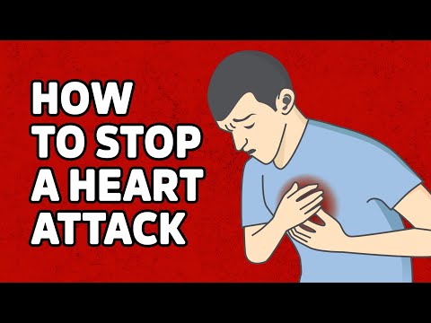 If You HAD to Pick One Stroke or Heart Attack