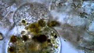 <em>Holophrya discolor</em>