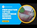 Preparation Tip For Direct Resin Bonded Bridges