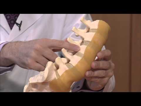 Jacob Buchowski, MD, MS, on spine fractures
