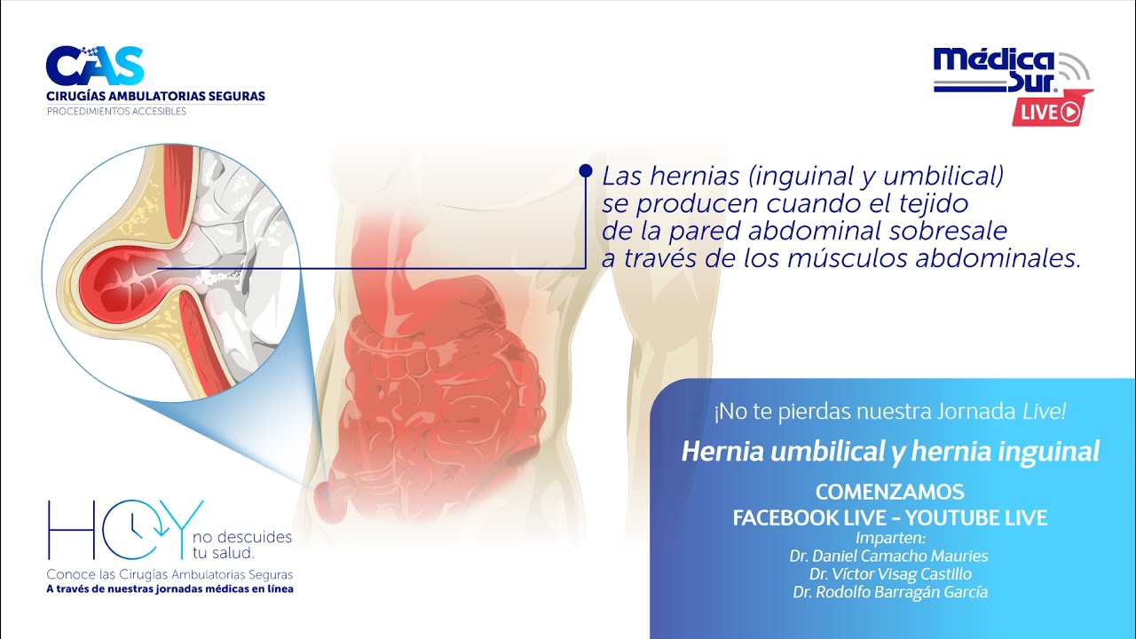 Victor Visag Castillo-4