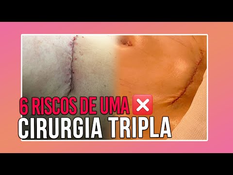 6 Risks of Triple Surgery - Plastic Surgery