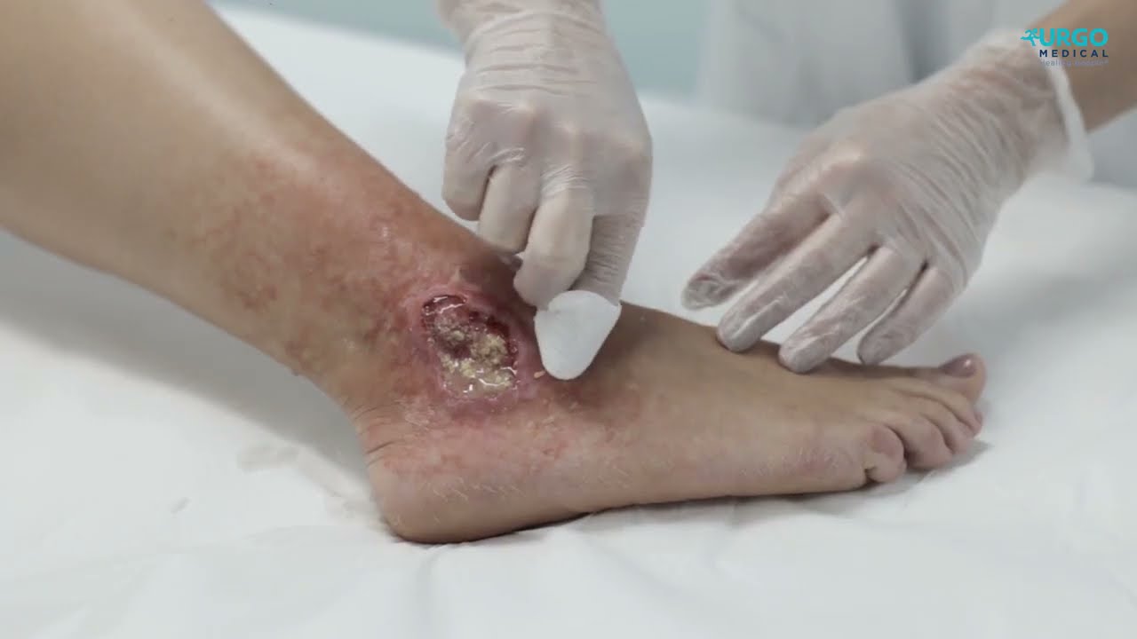 Watch Now Gel de Limpeza Curatec PHMB - Compre na Vitae Saúde Gel de Limpeza Curatec PHMB - Compre na Vitae Saúde