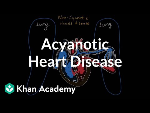 What is acyanotic heart disease? | Circulatory System and Disease | NCLEX-RN | Khan Academy