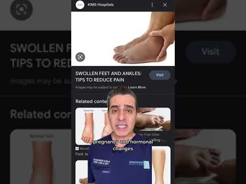 Foot Symptom Pregnant Women Need to Know About!
