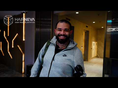 Henry’s Complete Hair Transplant Journey in Istanbul, Turkey: From Initial Consultation to the Final Experience at HairNeva