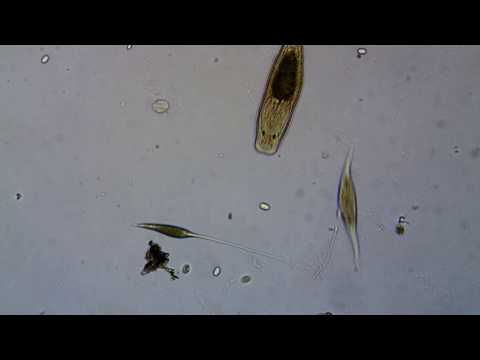 Lacrymaria Bites Amphileptus