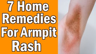 7 Home Remedies For Armpit Rash