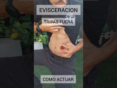 , title : 'Tripas fuera Como actuar.#supervivencia #emergencia #tutorial'