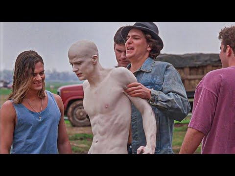 They Bully This Albino Guy, Unaware He’s A Rare-Disorder With Something Special | Movie Recap