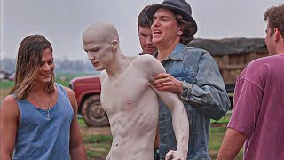 They Bully This Albino Guy, Unaware He’s A Rare-Disorder With Something Special | Movie Recap