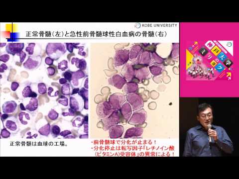 第3回シンポジウム「神戸大学のミリョク」2_『遺伝情報の解読の仕組みと病気』